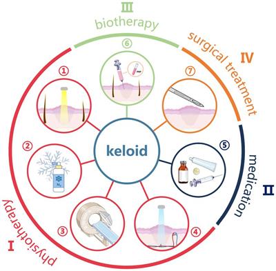 Progress in the clinical treatment of keloids